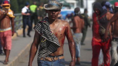 Cúcuta, 2019. február 26. A Simón Bolívar hidat lezáró venezuelai rendõrökkel történt összecsapásokban megsebesült venezuelai tüntetõk egyike a határ kolumbiai oldalán lévõ Cúcutában 2019. február 25-én. Nicolás Maduro venezuelai elnök három nappal korábban rendelte el a Kolumbiával közös határ egyes átkelõinek lezárását, hogy megakadályozza az Egyesült Államokból érkezõ segélyszállítmány bejuttatását az országba. Venezuelában hatalmi harc zajlik Maduro és a magát ideiglenes elnökké nyilvánító Juan Guaidó parlamenti elnök között. Guaidó, aki január 23-án kikiáltotta magát Venezuela ideiglenes elnökének, az Egyesült Államok és több más nyugati ország támogatását élvezi. MTI/EPA-EFE/Ernesto Guzmán Jr