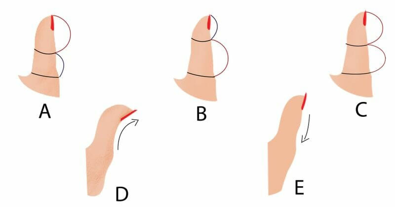 Milyen alakú a hüvelykujjad? A válasz felfedheti a titkokat a személyiségedről