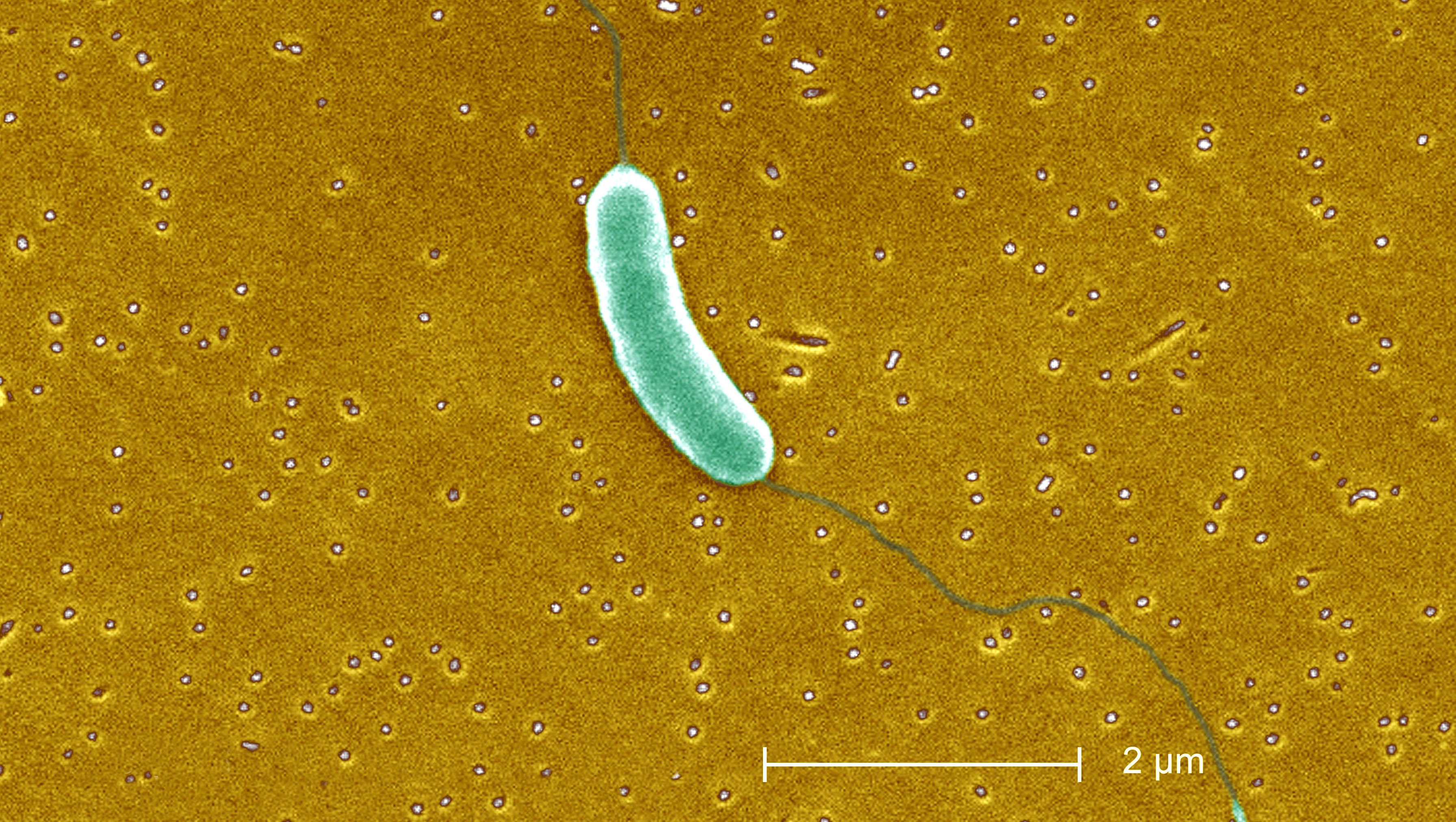 Húsevő baktériumok bukkantak fel Amerika keleti partvidékén