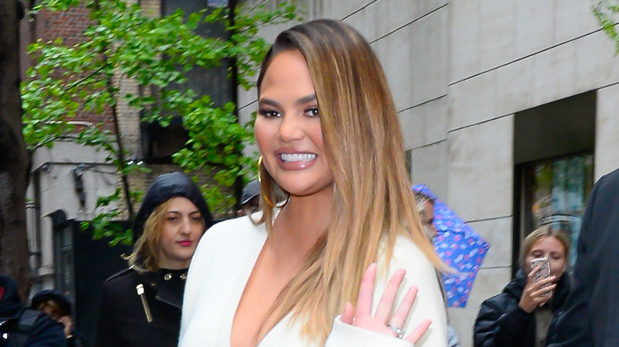 Chrissy Teigen a hónalját botoxoltatta