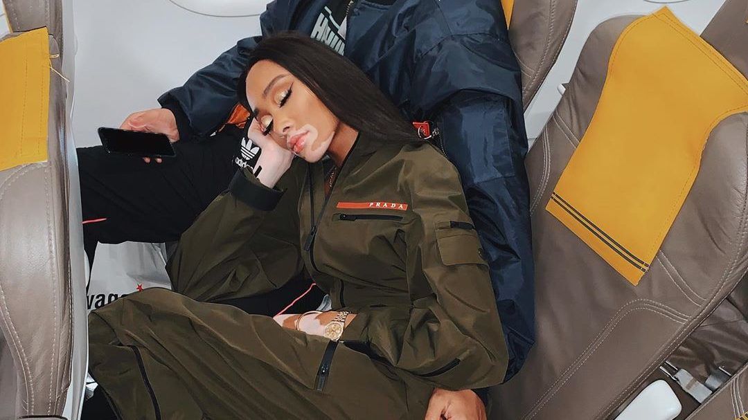 Winnie Harlow-nak turistaosztályon kellett repülnie, betámadták „panaszkodás” miatt