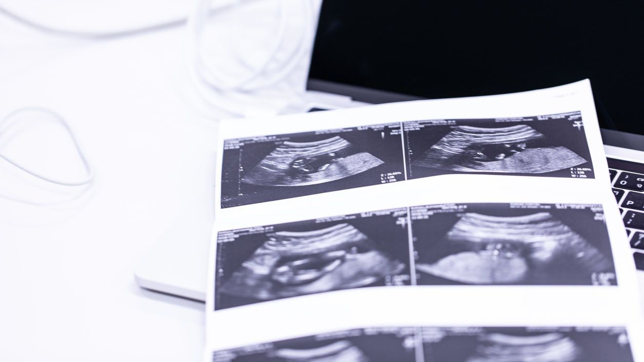 Véletlenül rossz nőnek hajtott végre abortuszt egy orvos