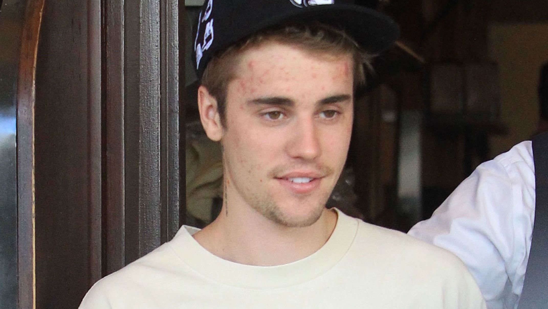 Justin Bieber: Azt hitték, hogy meth függő vagyok, nem tudták, hogy Lyme-kórral diagnosztizáltak