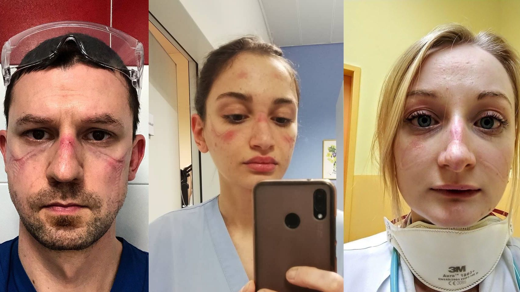 Ilyen a koronavírus ellen harcoló egészségügyi dolgozók arca a világ minden tájáról