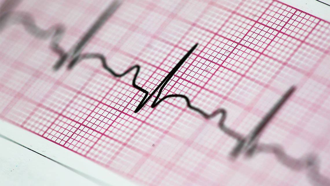 EKG-val együtt lopta el az orvos autóját a betörő