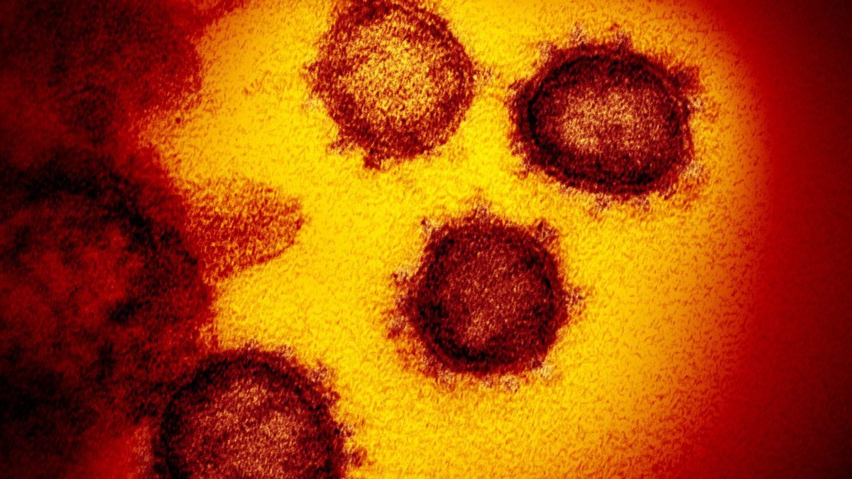 Újabb 23 ember fertőzödött meg koronavírussal, öten meghaltak