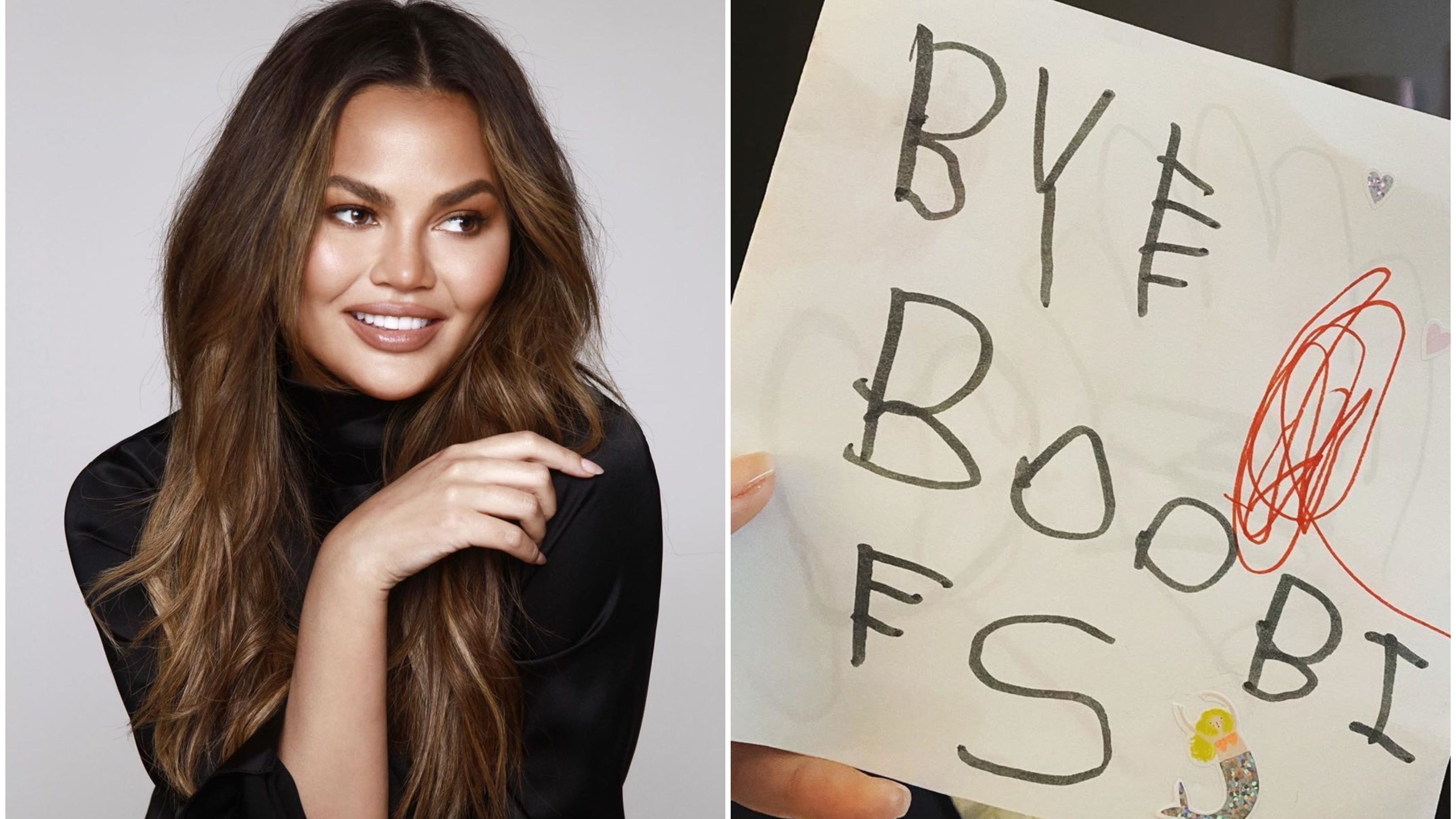 Megvolt Chrissy Teigen mellműtétje