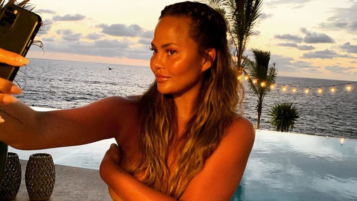 Chrissy Teigen megmutatta a mellműtétje után maradt hegeket