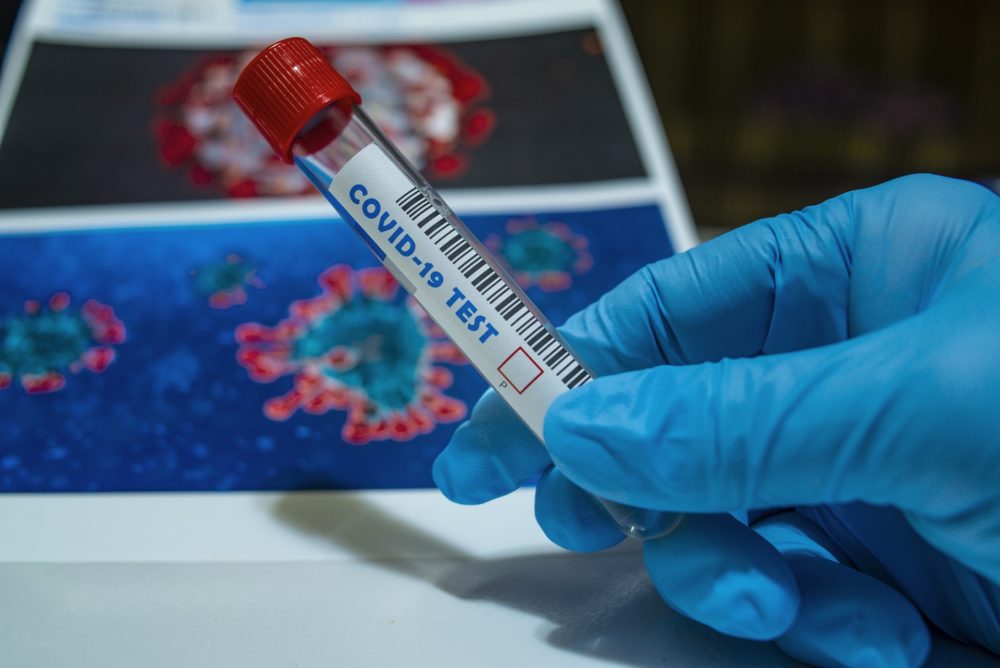 Majdnem százezer forintos koronavírus-tesztet végeznek két magyar állami kórházban is