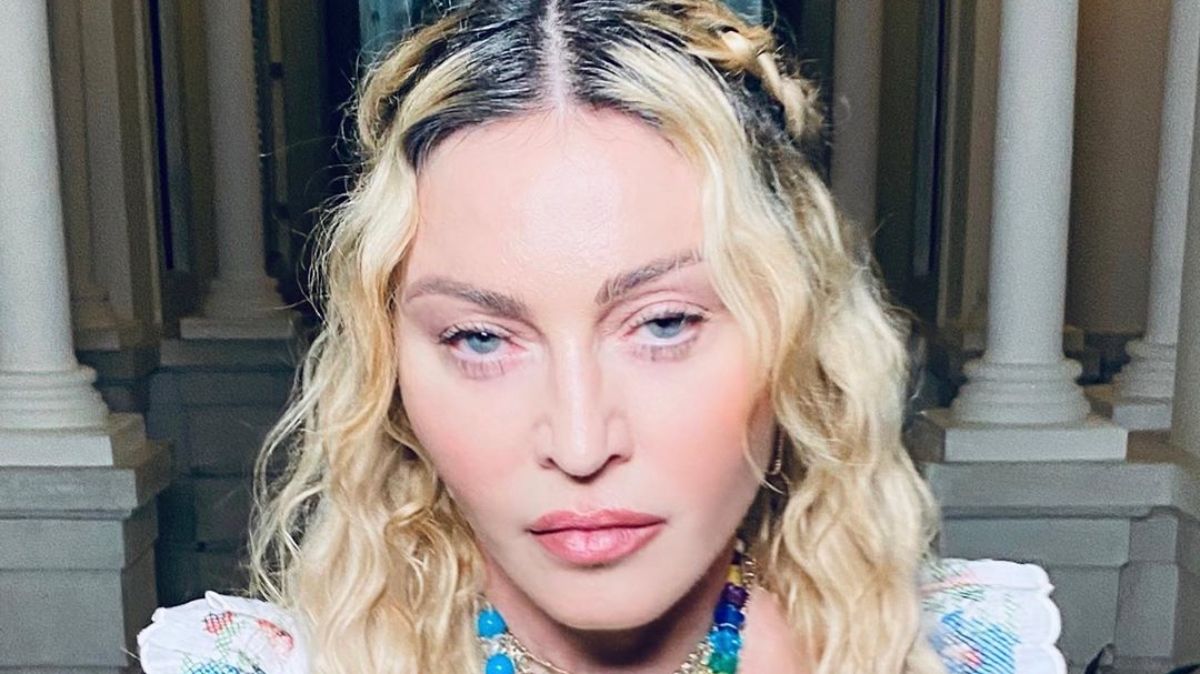 Madonna 62 éves lett, de valami nagyon nem stimmel az arcával