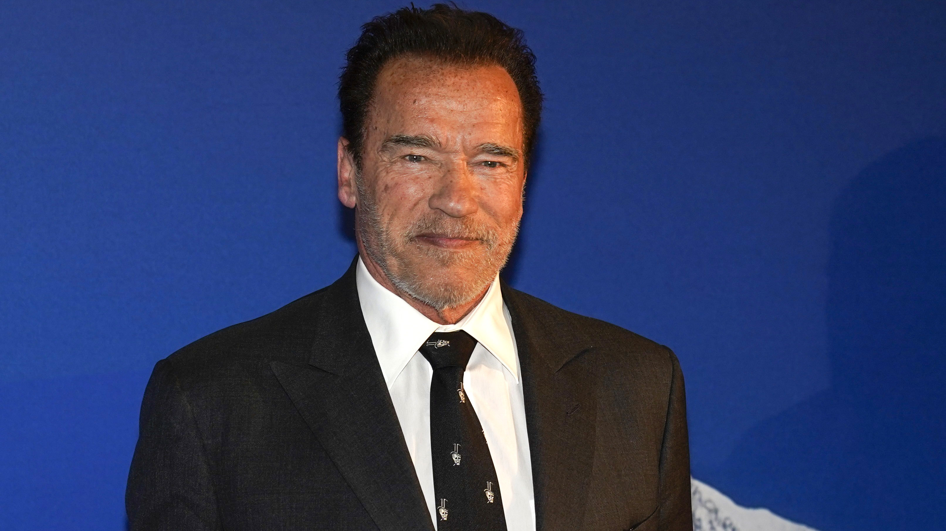 Arnold Schwarzeneggernek szívműtétje volt, de már sétálgat