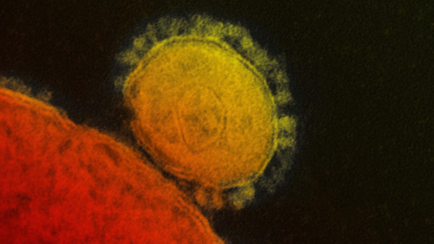 Mutálódik, de nem fertőz jobban a koronavírus