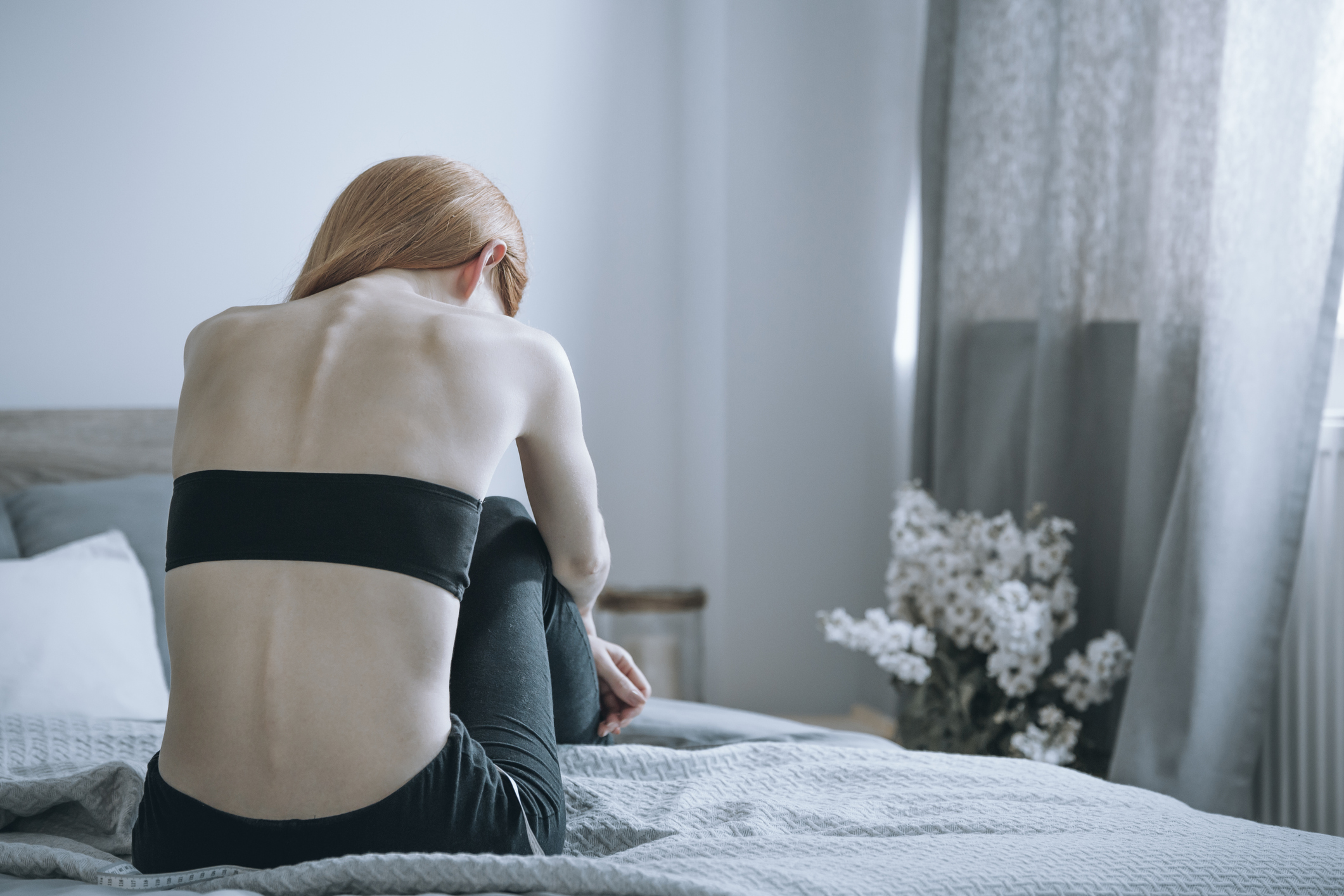 Az anorexia miatt vesztette életét az Insta-sztár