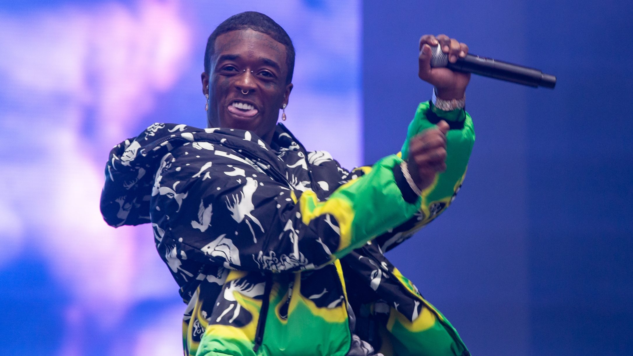 A rapper Lil Uzi Vert 24 millió dolláros gyémántot ültetett a homlokába, ami aztán bevérzett