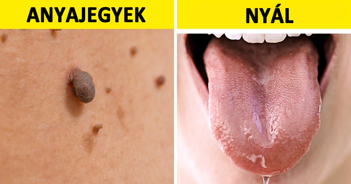 Nyolc váratlan jele a terhességnek, amikre nem is gondolnál