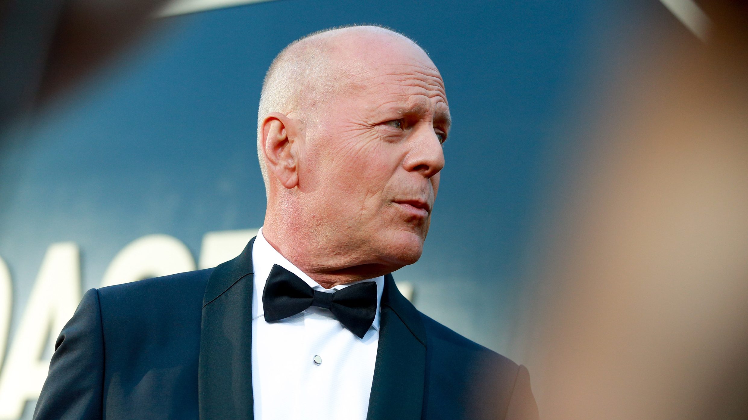 Nőtt a tudatosság az afáziával kapcsolatban Bruce Willis miatt