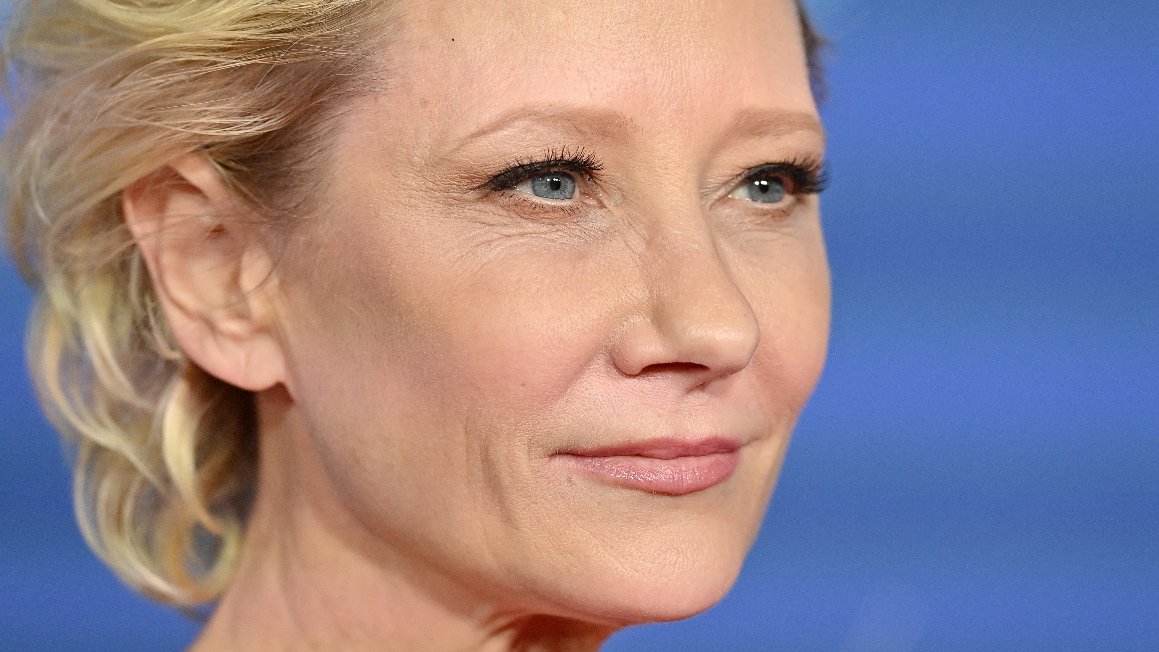 Anne Heche állapota stabil a súlyos autóbalesetét követően