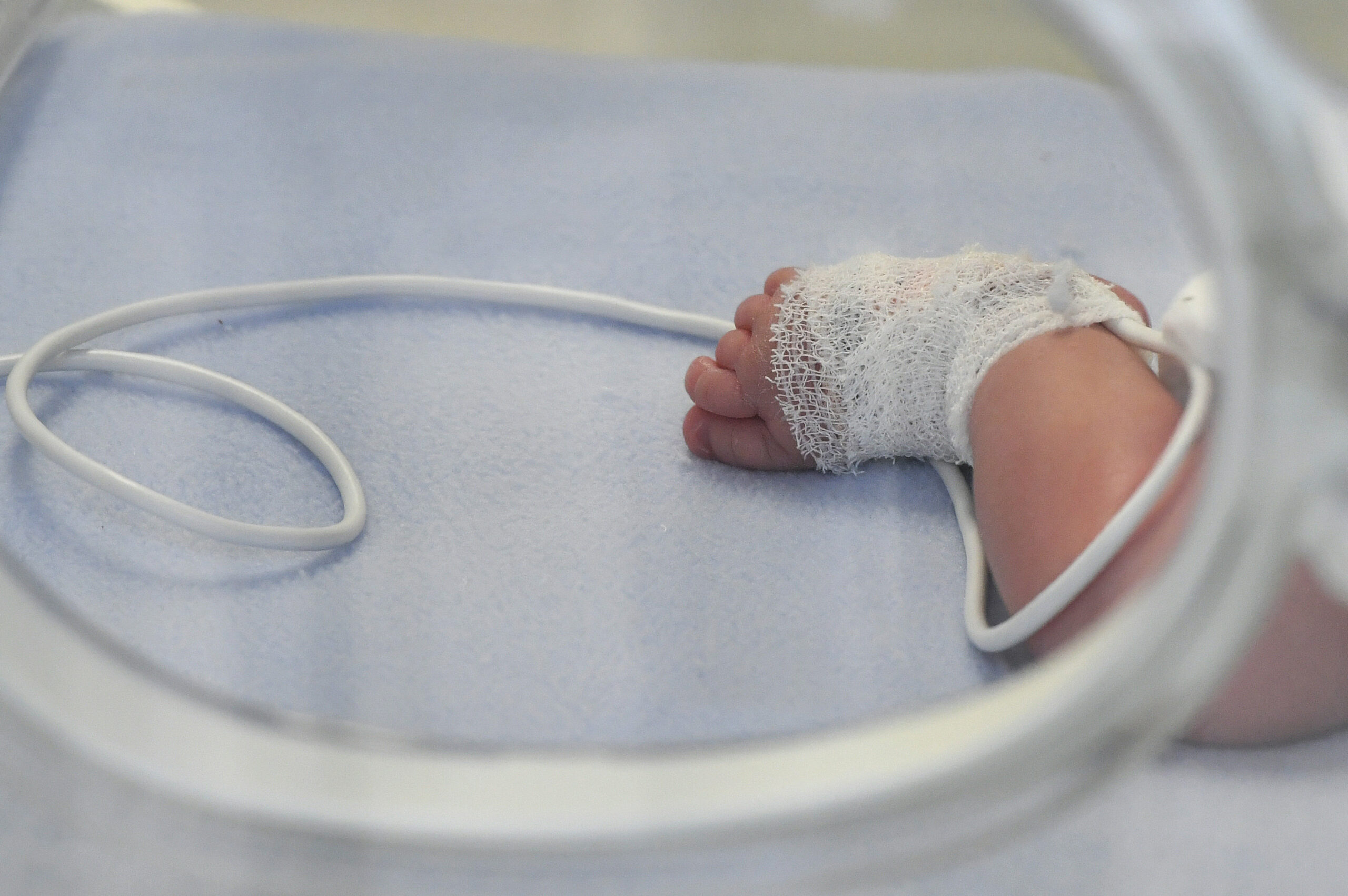 Egy alig néhány órás újszülöttet helyeztek el a szolnoki kórház inkubátorában